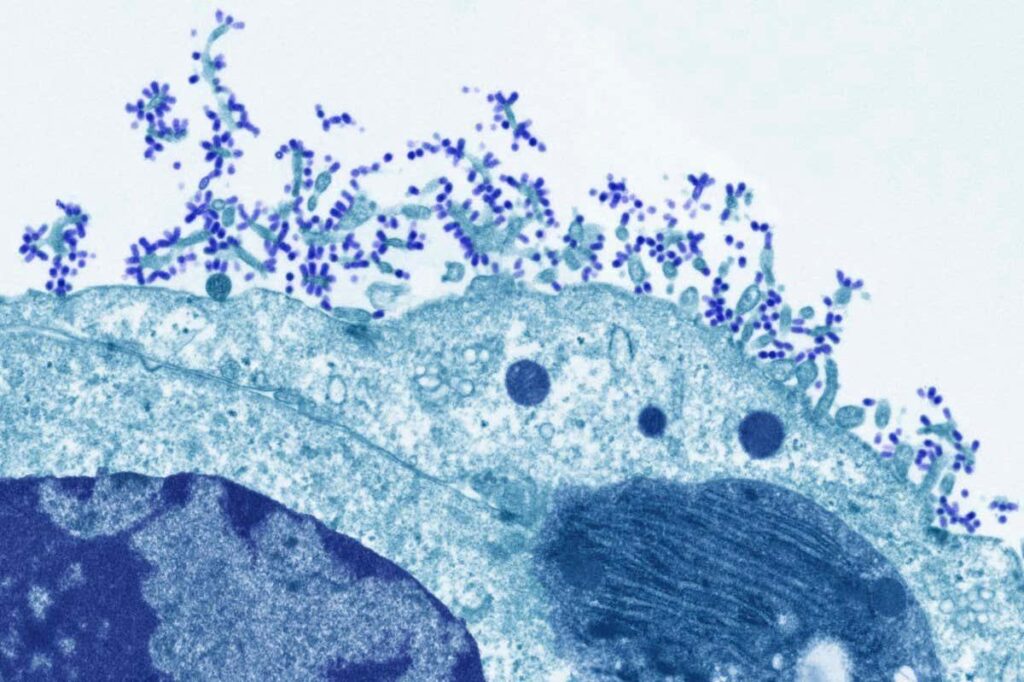 South Carolina flu spread still among worst in US as conditions improve elsewhere – WBTV