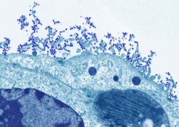 South Carolina flu spread still among worst in US as conditions improve elsewhere – WBTV