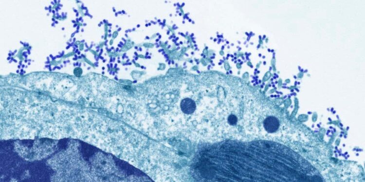 South Carolina flu spread still among worst in US as conditions improve elsewhere – WBTV
