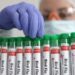 Louisiana reports first bird flu-related death in US – Reuters