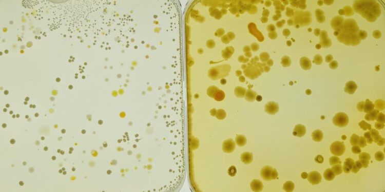 Nine people hospitalized in listeria outbreak linked to South Carolina food processor – The Guardian