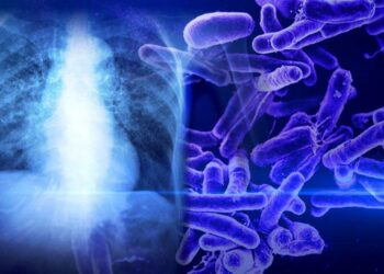 The tuberculosis outbreak in Kansas is alarming. It’s not the biggest in US history though, CDC says – AP News