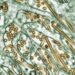 H5 Bird Flu: What You Need to Know About the Latest Outbreak